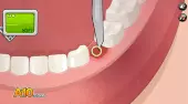 Operace zubu