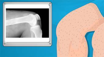 Operace kolena | (Operate Now! Knee Surgery) | Online hra zdarma | Superhry.cz