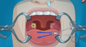 Operace mandlí | (Operate Now! Tonsil Surgery) | Online hra zdarma | Superhry.cz