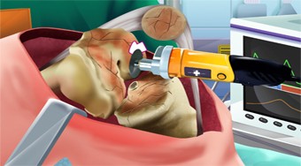 Knee Surgery Simulator | Online hra zdarma | Superhry.cz